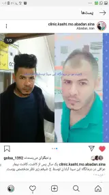 کلینیک تخصصی پوست و کاشت مو ابن سینا