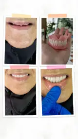لابراتوار دندانسازی لبخند