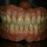 دندانسازی دندان مصنوعی لابراتوار دندان سازی تضمینی