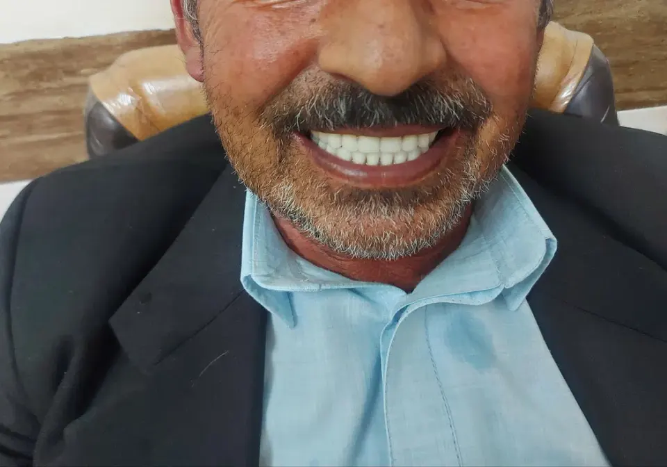 دندانسازی ترکان