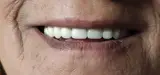 دندانسازی دکتر محمدرضاعلیکاهی