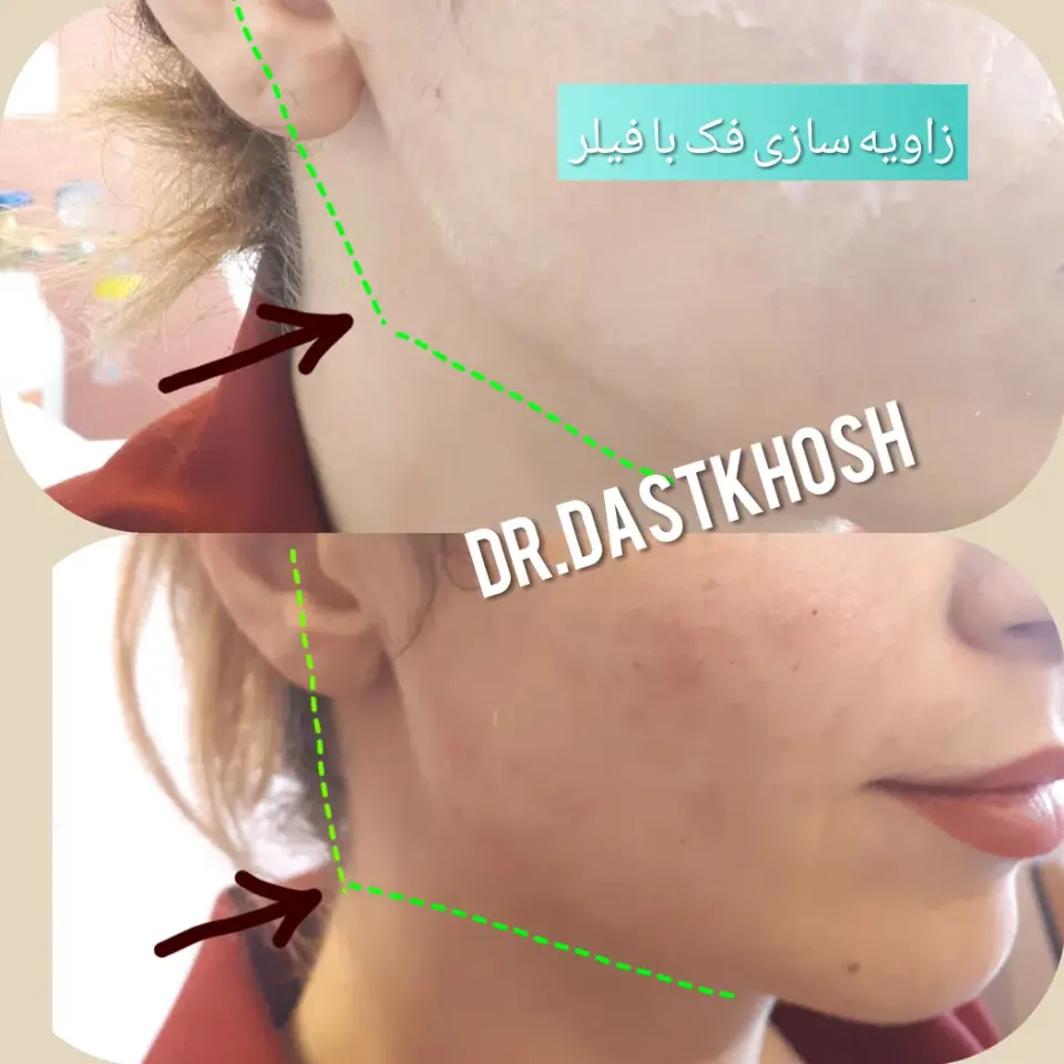 مطب دکتر علی دستخوش