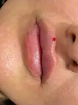 کلینیک زیبایی و لیزر آیتک پرند