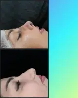 کلینیک زیبایی راشدی