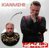 کاشت مو کیانمهر در ارومیه