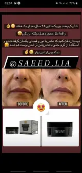 فروش محصولات تخصصی تراست
