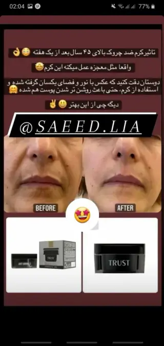 فروش محصولات تخصصی تراست
