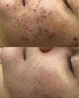 فیشال تخصصی و دستگاه مواد پیشرفته بابل