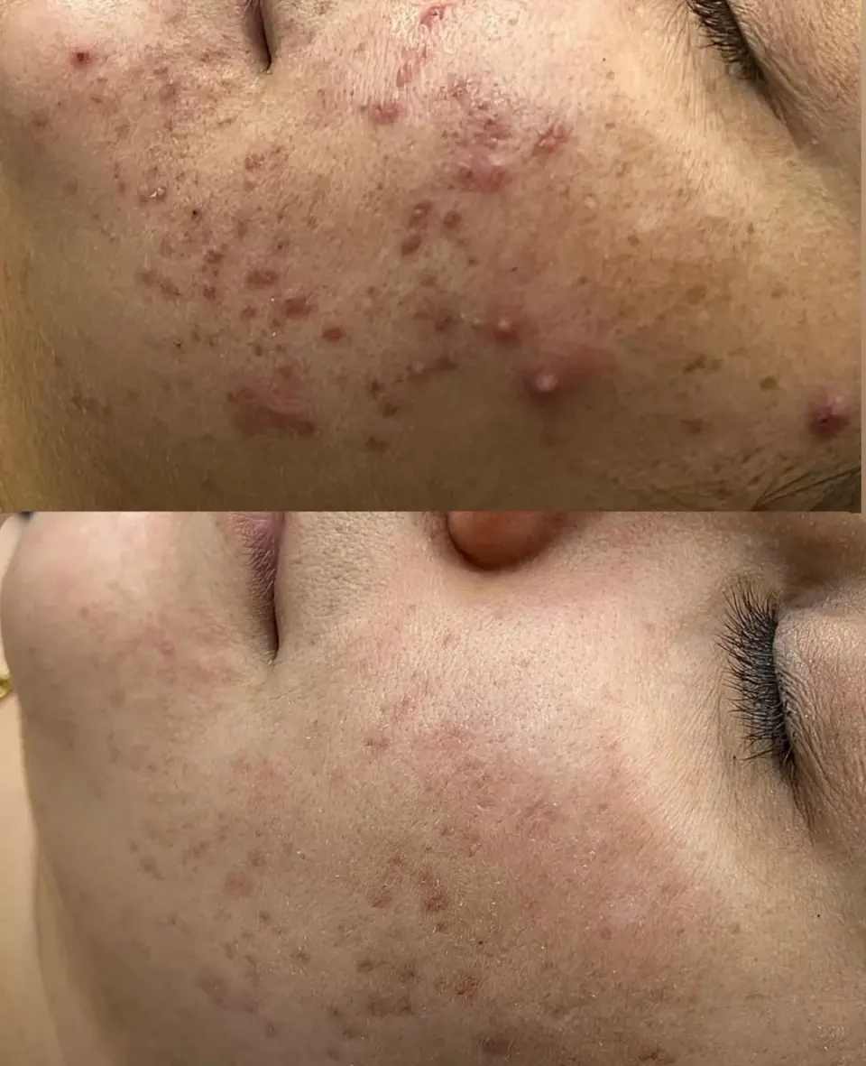 فیشال تخصصی و دستگاه مواد پیشرفته بابل