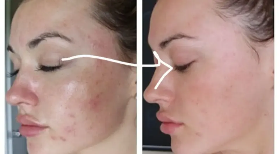 خدمات تخصصی پاکسازی پوست و فیشال نگاره