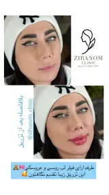 کیلینیک زیبا نوم
