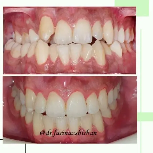 متخصص ارتودنسی و ناهنجاری فک