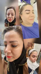 کلینیک زیبایی پوست و مو آتریسا