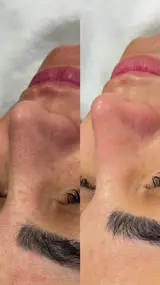 فیشال وپاکسازی تخصصی صورت و بدن اصفهان