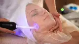 فیشال و پاکسازی پوست فاطمه کاویانی