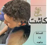 کلینیک کاشت مو و ابروی لاوین