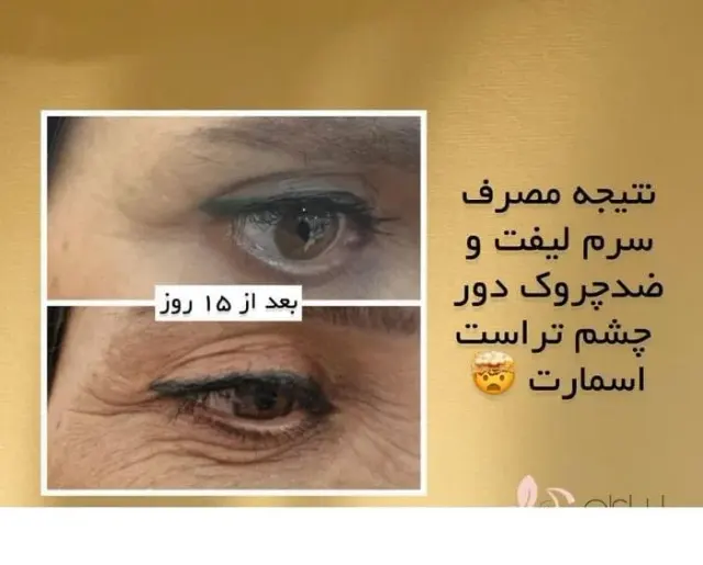 لوازم آرایشی و بهداشتی تراست