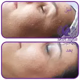 خدمات پاکسازی پوست آیلا اسکین