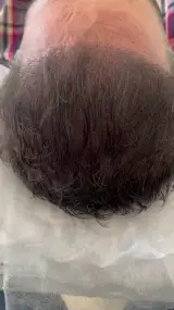 خدمات میکرواسکالپ