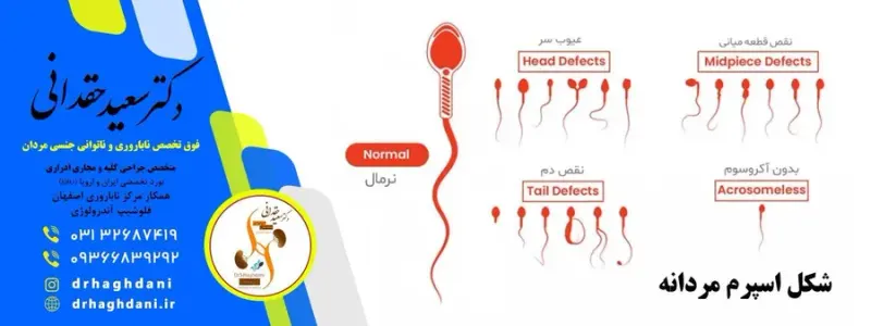 فوق تخصص درمان ناباروری در اصفهان