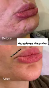 دکتر علی مقدمی (پزشک پوست مو زیبایی)