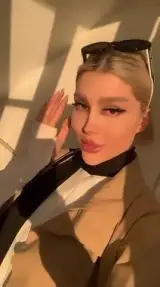 میکروبلیدینگ زنجان فیبروززنجان
