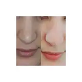 فشیال پوست