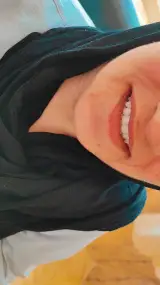 دندان سازی پیشگامان(با مدیریت شلیر خلیلی