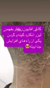 مرکز لیزر موهای زائد تخصصی777