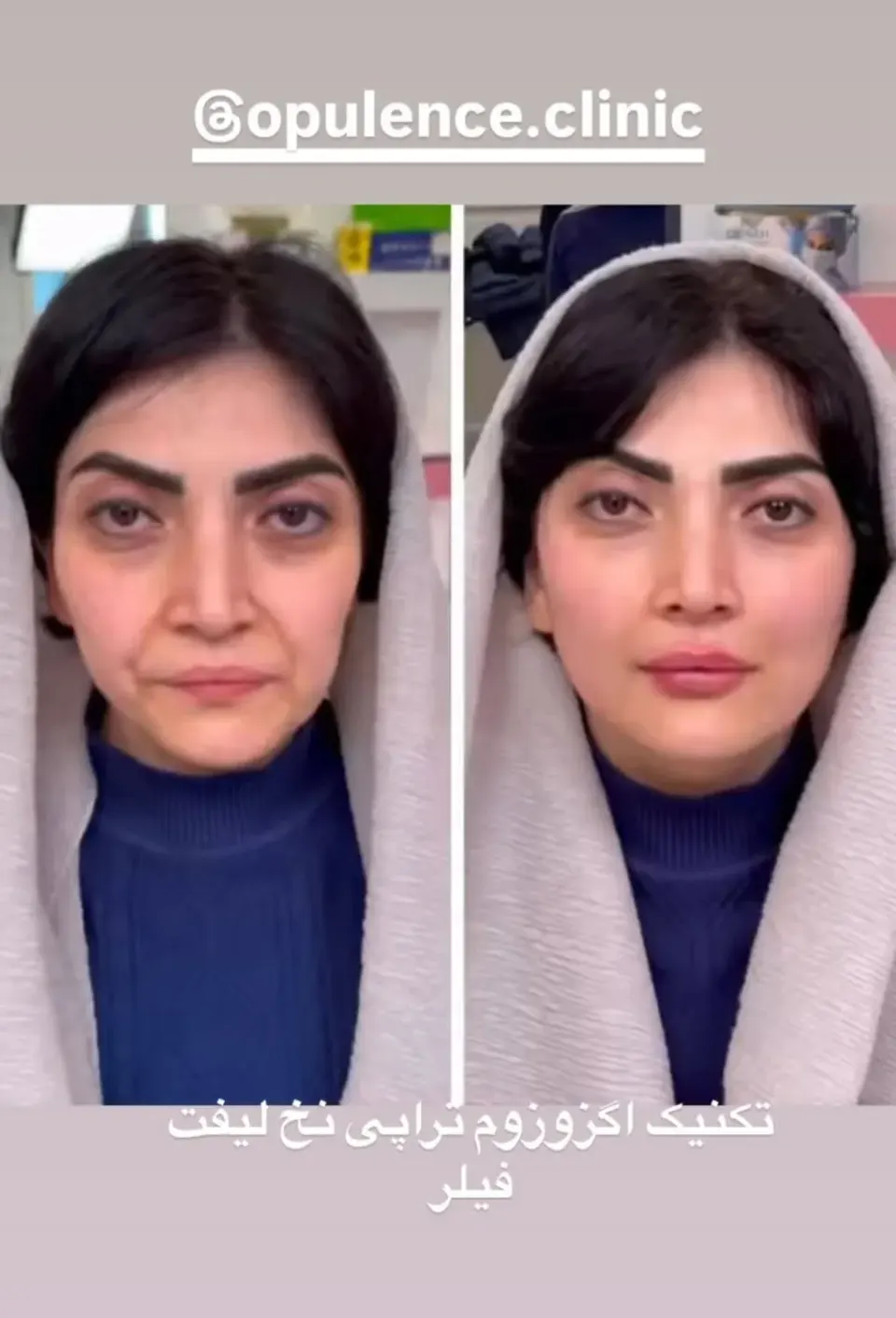 کلینیک زیبایی و لاغری آپیلنس