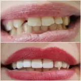 مطب دندانپزشکی دکتر راضیه صنیعی