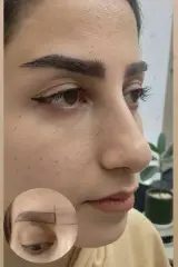 کلینیک زیبایی ورمیس