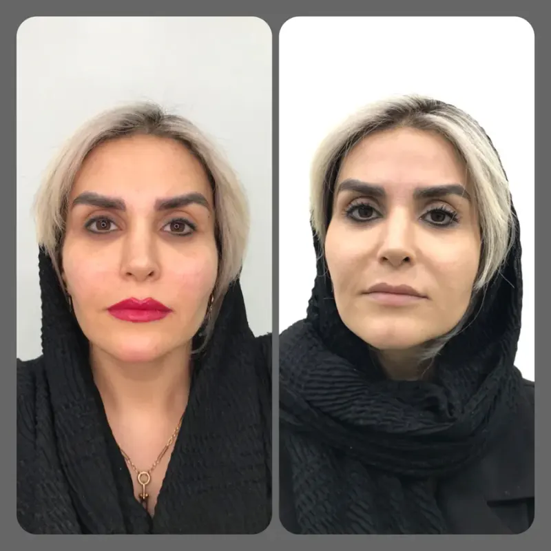 کلینیک لیزر و زیبایی مهرُنا