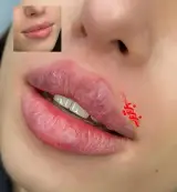 کلینیک پوست و زیبایی نینانیدل
