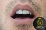 دندانسازی سنه دنت