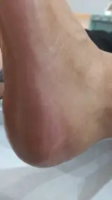 کفسابی و پدولوژی ناخن خانمها و آقایان