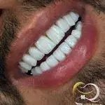 کلینیکدندانپزشکی دنتال آرنا-بیمه نیستیم