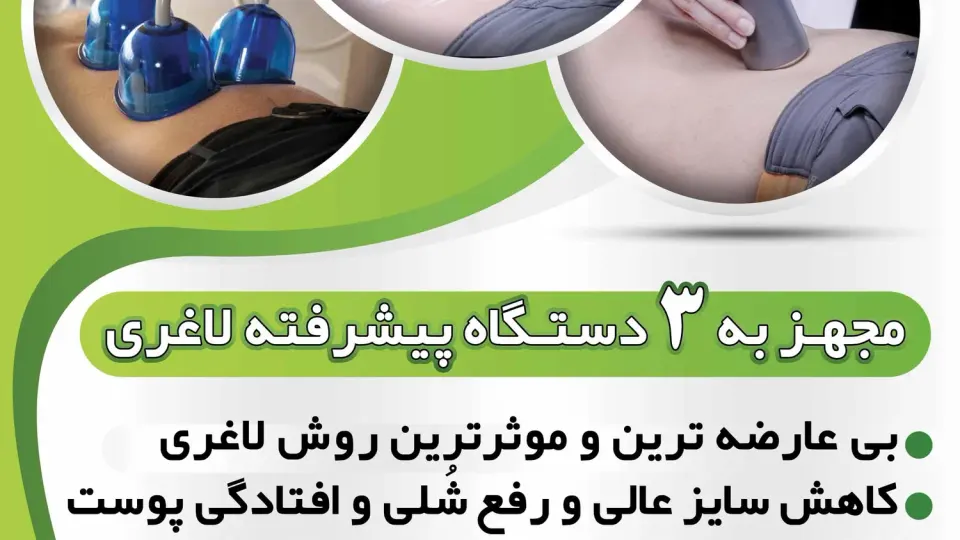 دندانسازی یعقوبی
