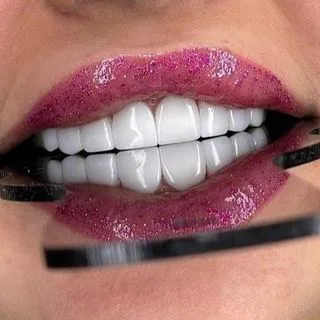 دنتال ونیز
