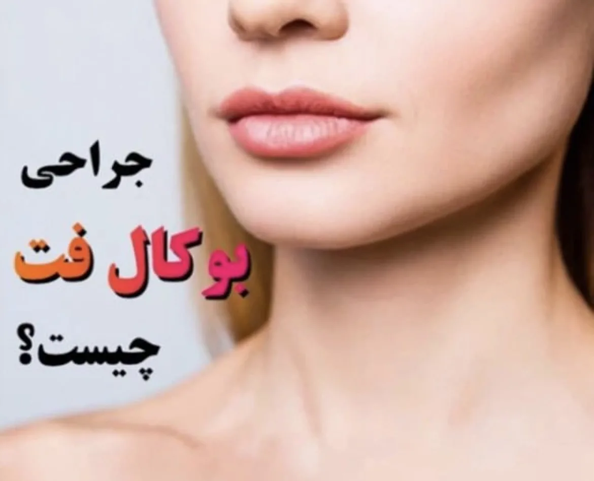 مرکز جراحی بوکال فت در کرج