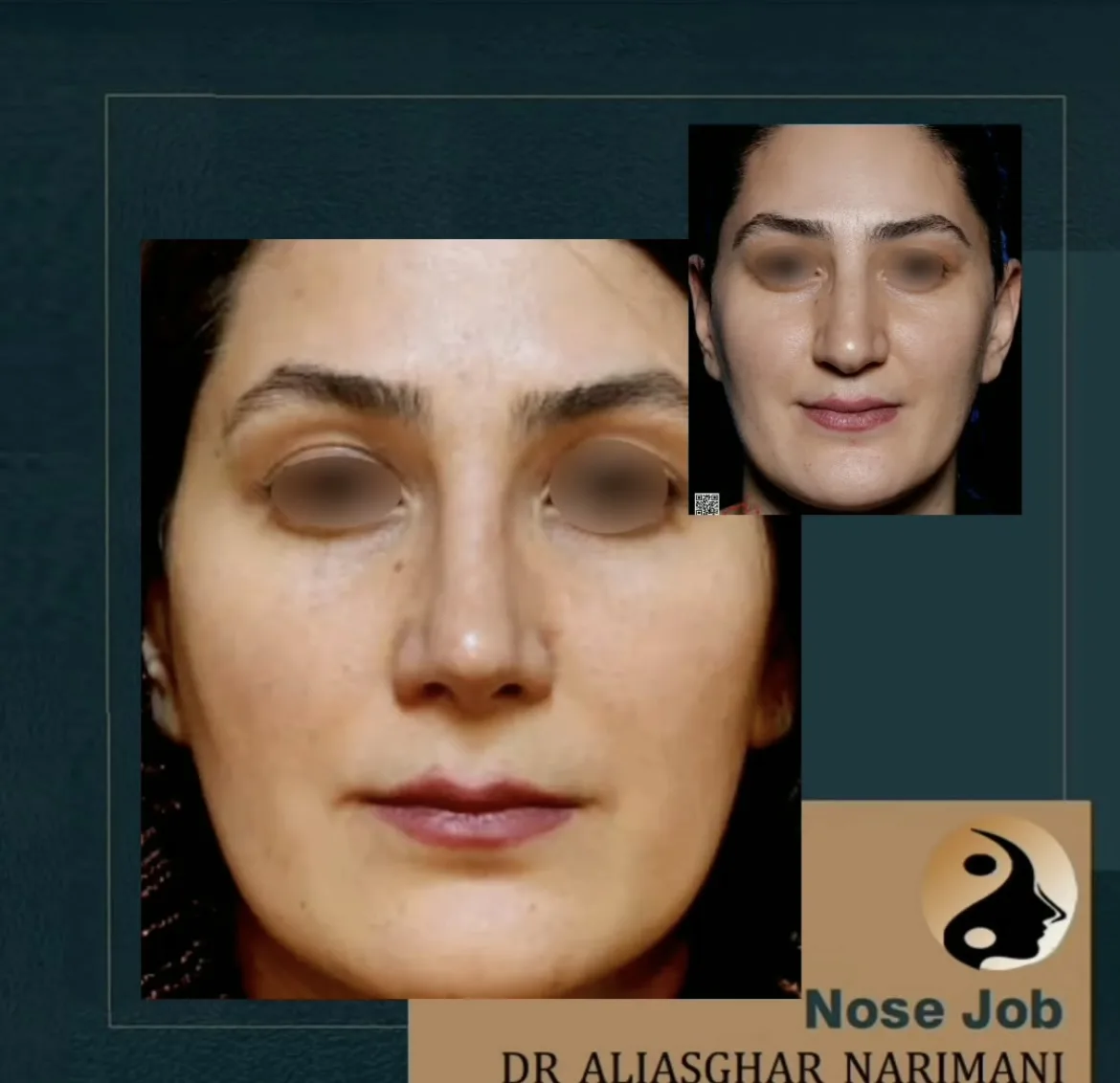 دکتر علی اصغر نریمانی/جراح بینی