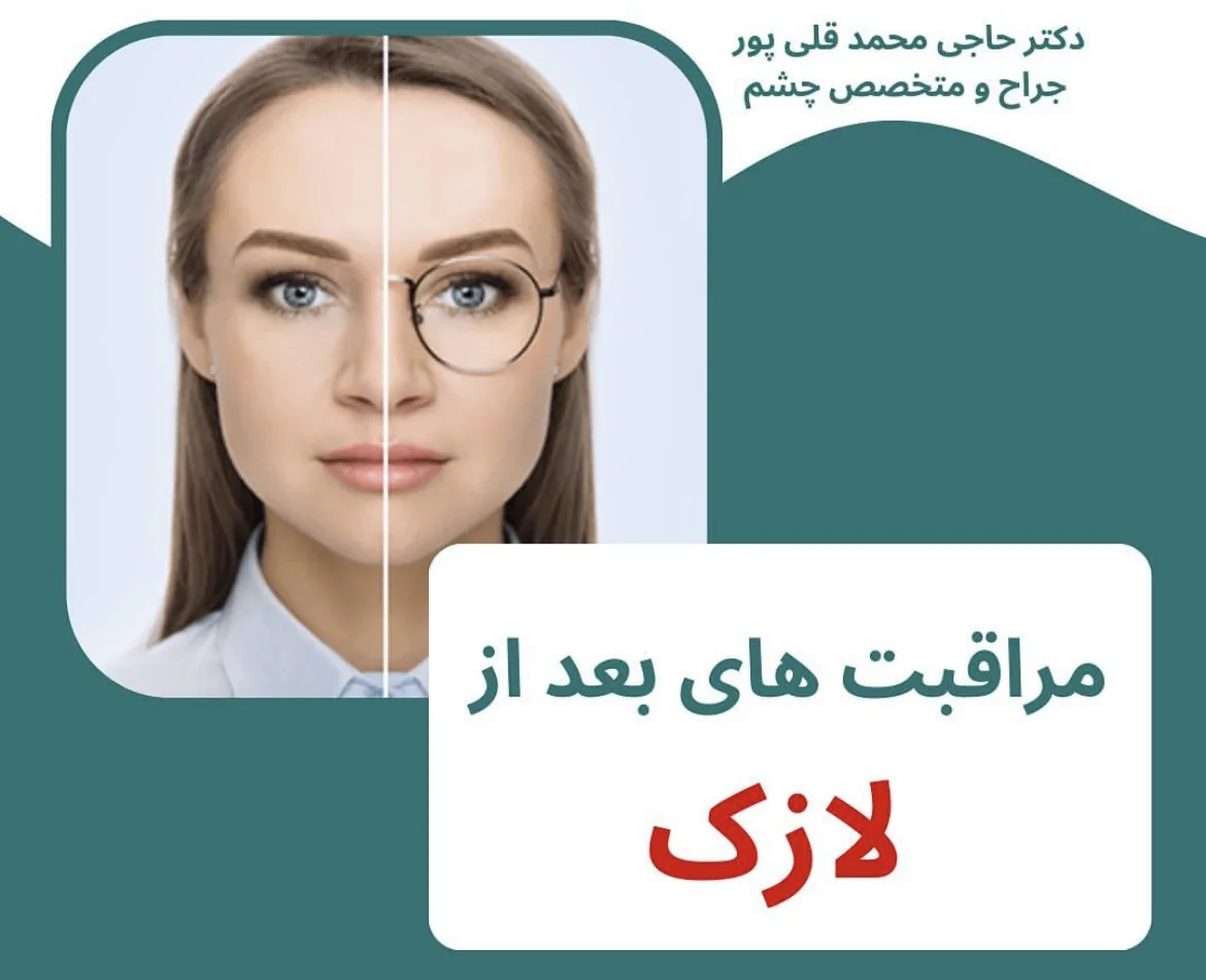 جراح و متخصص چشم/لازک/لیزیک