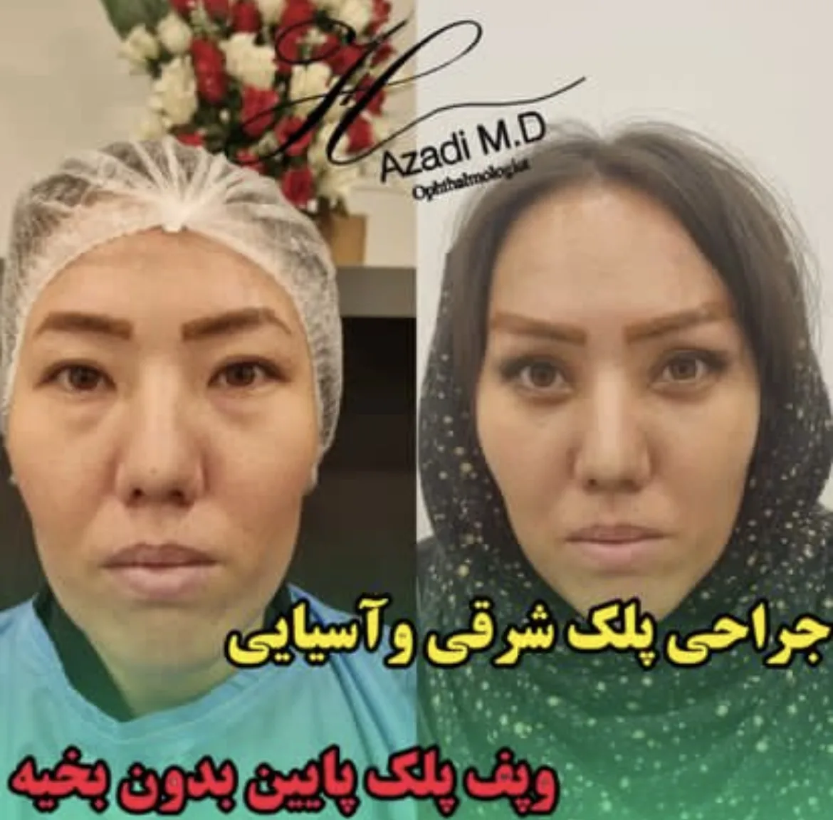 دکتر حمید آزادی/متخصص چشم و لیزیک،جراحی زیبایی پلک و بلفارو