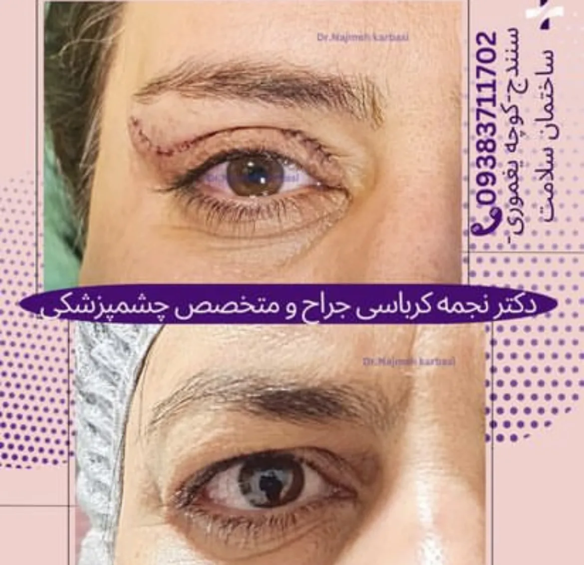 دکتر نجمه کرباسی جراح و متخصص چشمپزشکی/لیزیک سنندج
