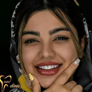 کامپوزیت/ایمپلنت/ارتودنسی