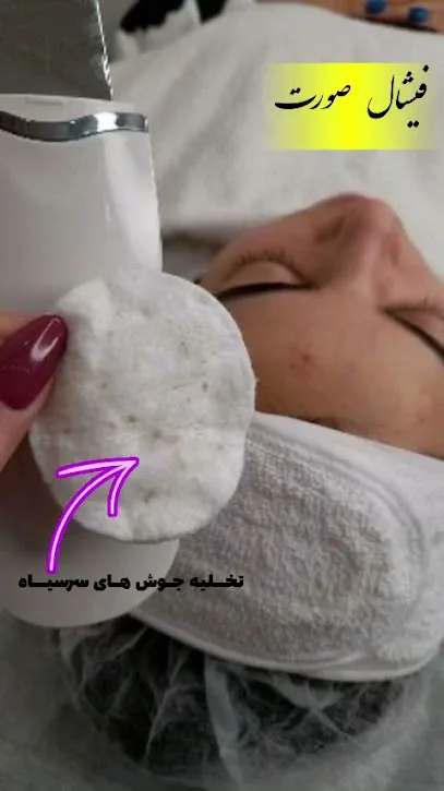 مرکز لیزر برتر
