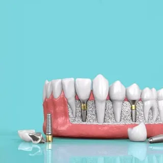 دندانپزشکی دکتر رسول ابوالحسنی