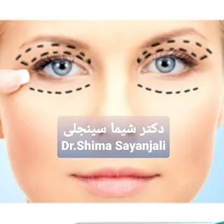 جراح زیبایی دکتر شیما سینجلی