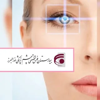 لیزیک نور البرز