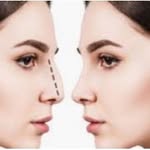دکتر نیک تبار/جراح پلاستیک